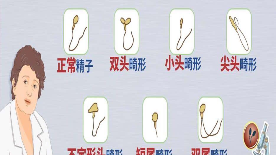 精子