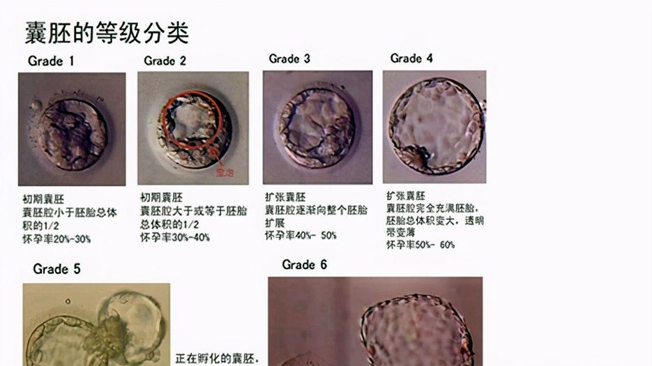 试管婴儿囊胚等级是如何划分的？试管婴儿胚胎分级标准最新分享 (2).jpg