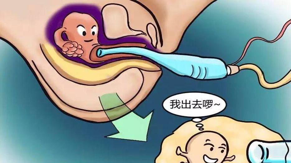 取卵.jpg
