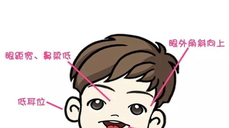21号染色体异常