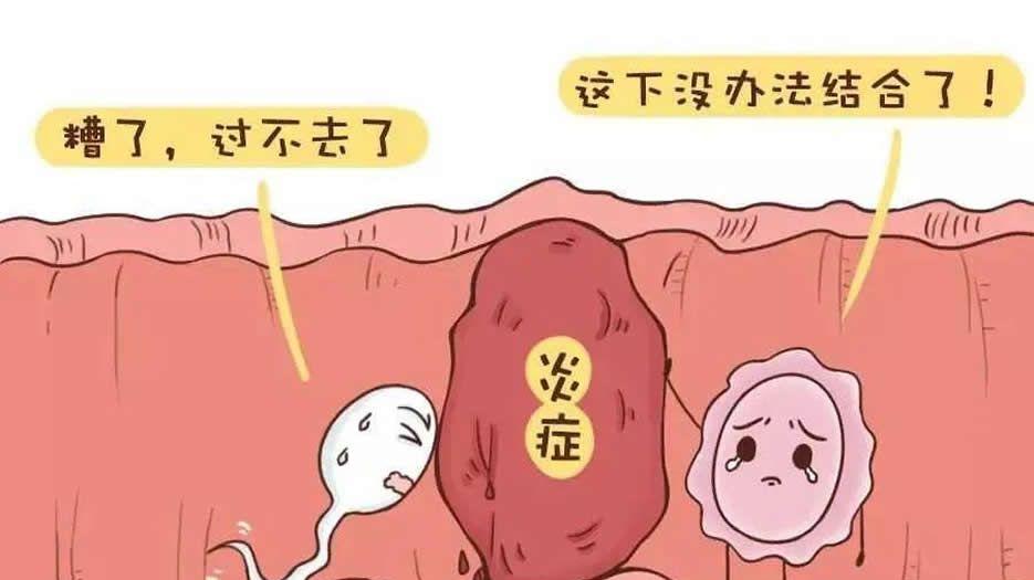 输卵管堵塞图片 (2).jpg