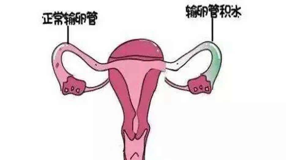 子宫