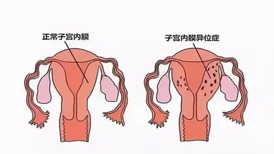 u=1599001916,2805160369&fm=253&fmt=auto&app=138&f=JPEG.webp.jpg