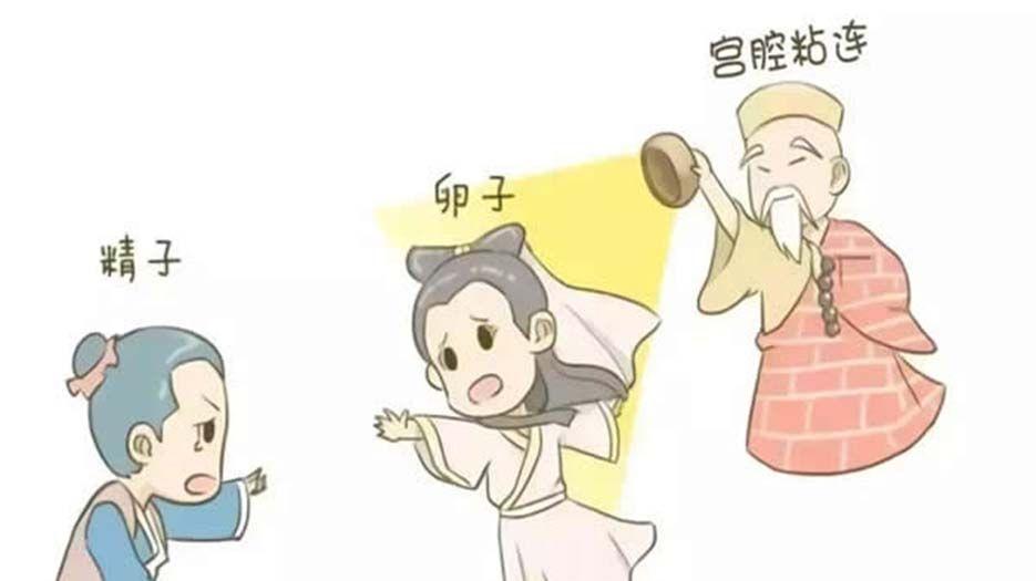 盆腔积液 (2).jpg