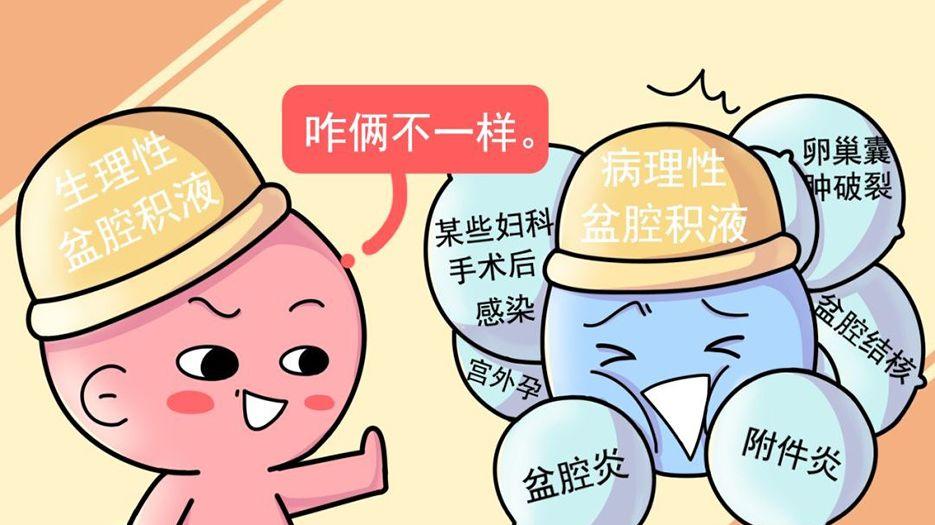 盆腔积液.jpg
