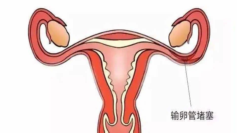 src=http___pic4.zhimg.com_v2-5d73b83360e006539b8fa80f6e9d434f_b.jpg&refer=http___pic4.zhimg.jpg