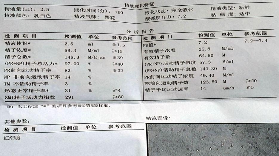 精子畸形可以怀孕生育吗？专家解读精子畸形率高对生育的影响 (2).jpg