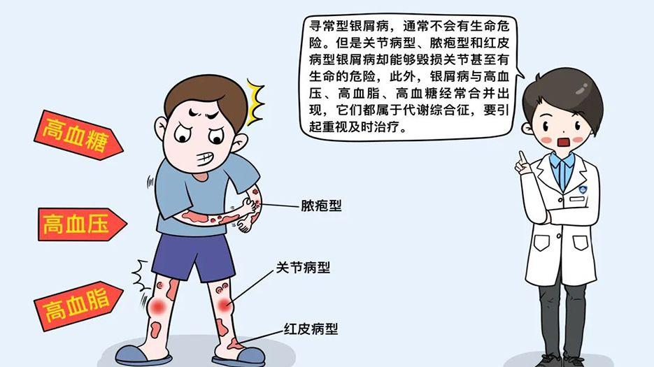 银屑病的危害.jpg