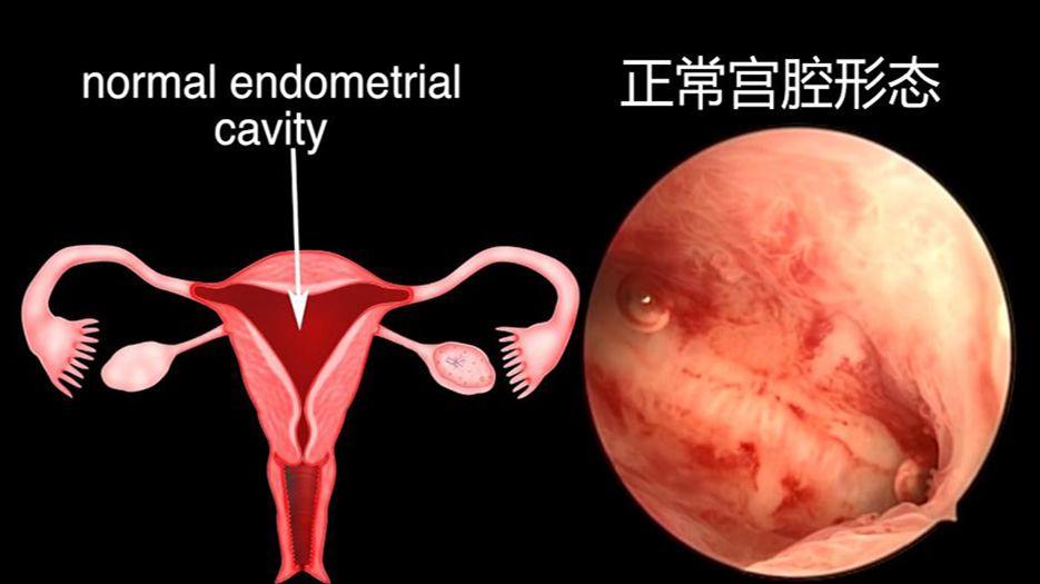 宫腔镜.jpg