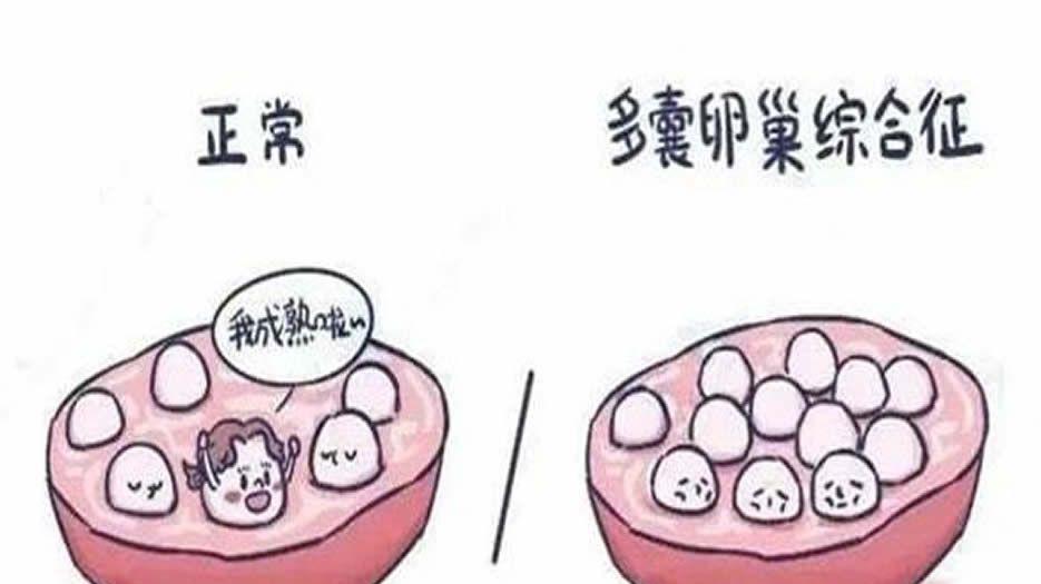 多囊