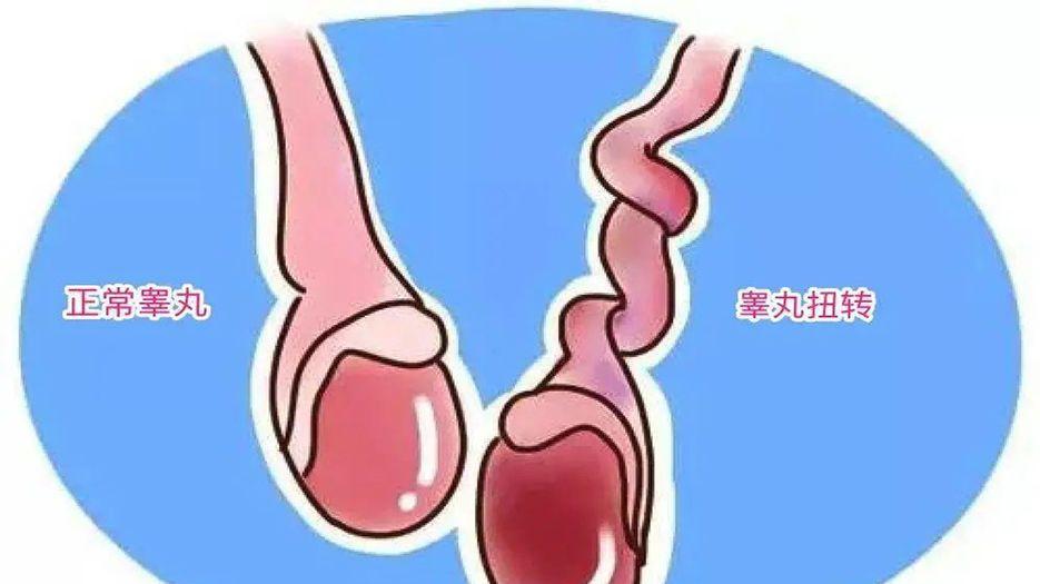 如睾丸发育异常.jpg