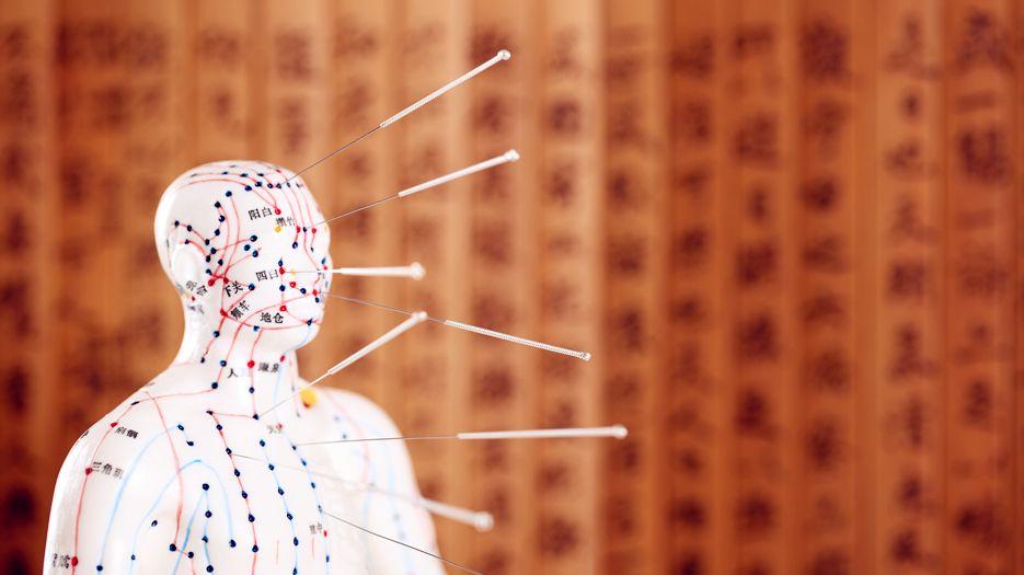 针灸对试管婴儿是否有帮助？专家解读试管婴儿针灸助孕 (9).jpg