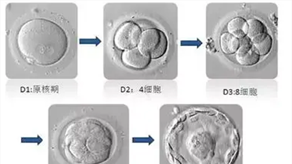 囊胚移植