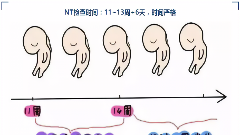确定孕周