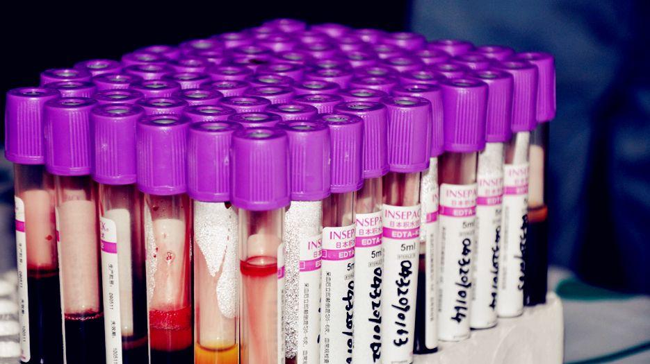 AMH值0.675调理后提高到1了还会怀孕嘛？专家解读amh值多少可以正常怀孕 (5).jpg
