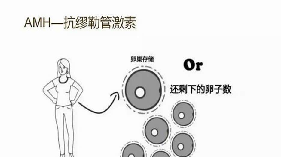 AMH值是什么