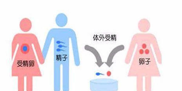 50岁怀孕做试管婴儿的费用明细介绍
