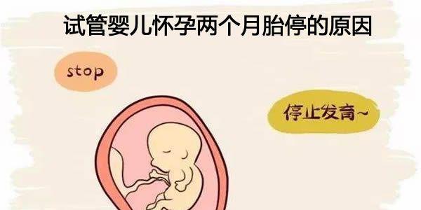 试管婴儿怀孕两个月胎停的7个原因介绍