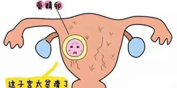 子宫异常