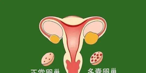 多囊可以直接促排卵立马做试管婴儿吗