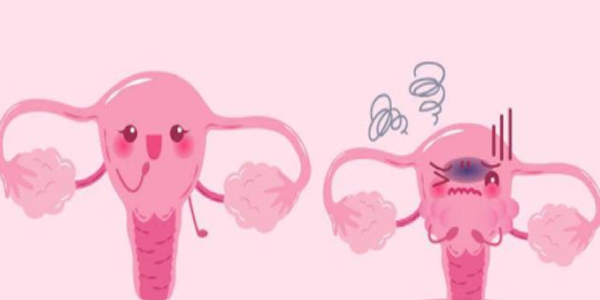 这4种妇科疾病会影响到试管婴儿的最终结果