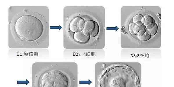三代试管婴儿养囊成功比例高吗