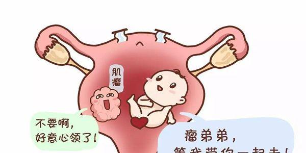 子宫肌瘤做试管婴儿适合哪种促排方案