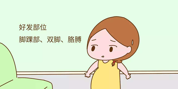 什么是银屑病