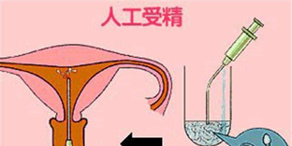 小蝌蚪找爸爸之人工授精如何优化精子