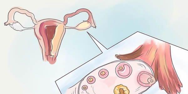 做试管婴儿促排并不会导致女性提前闭经