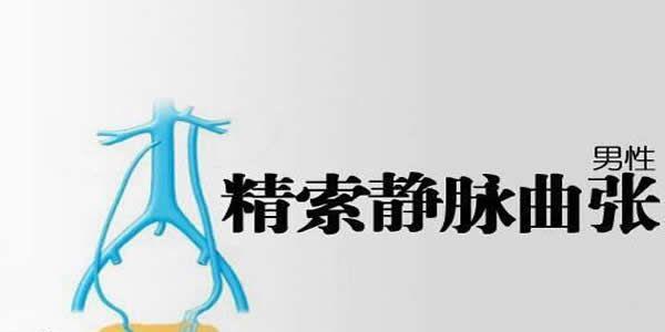 男性精索静脉曲张能做试管婴儿吗