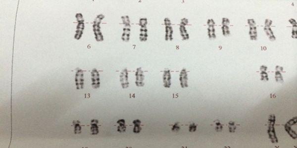 男性9号染色体臂间倒位只能做第三代试管婴儿吗-生殖科普