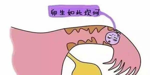输卵管阻塞