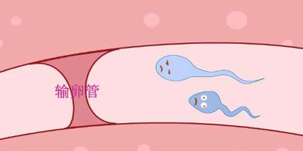 做了输卵管结扎能做试管婴儿吗-答案是肯定的