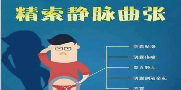 男性患精索静脉曲张会引起不孕吗