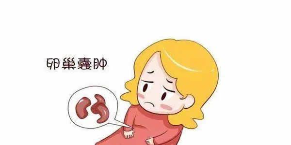 卵巢囊肿