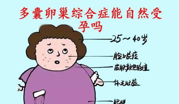 多囊卵巢综合症能自然受孕吗