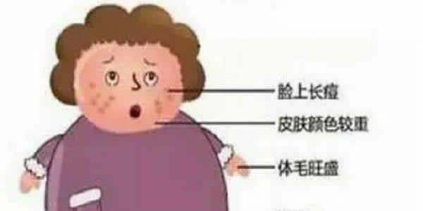 多囊卵巢综合症怎么调理才能好起来