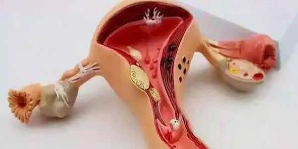 什么样的子宫内膜是好内膜？养好内膜4妙招！
