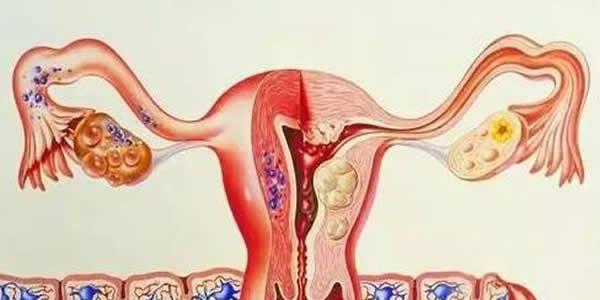 什么样的子宫内膜是好内膜？养好内膜4妙招！