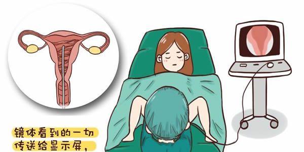 宫腔粘连的病理检查项目-三个检查可确诊 宫腔粘连的病理检查项目-三个检查可确诊