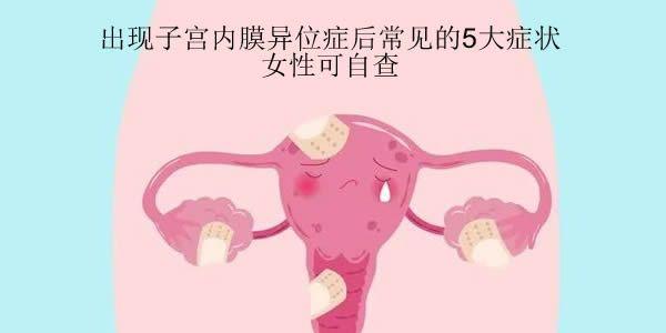出现子宫内膜异位症后常见的5大症状-女性可自查