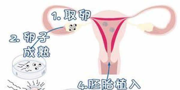 试管过程