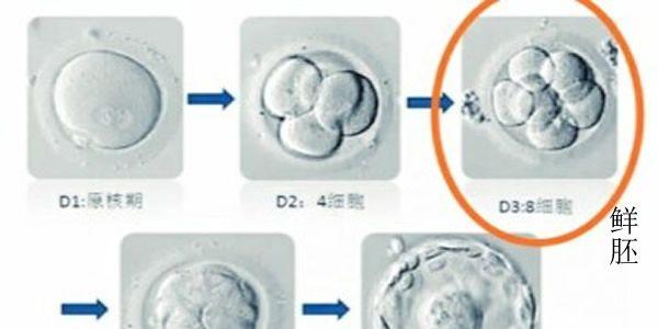 关于试管婴儿鲜胚、冻胚与囊胚的区别解惑