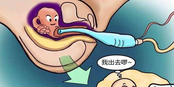 试管取卵受限