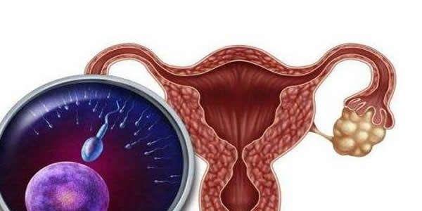 多囊卵巢综合征可以做试管婴儿吗  多囊卵巢综合征做试管婴儿成功率