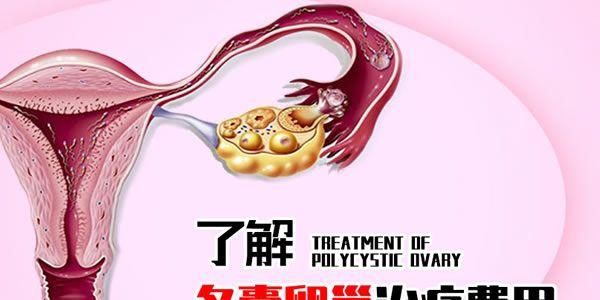 卵巢性不孕检查费用多少？