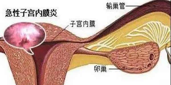 胚胎移植为什么不会着床  胚胎移植后遭遇生化妊娠