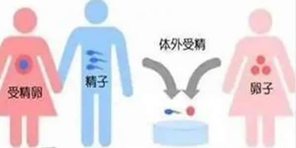 什么情况下才需要做试管婴儿试管婴儿