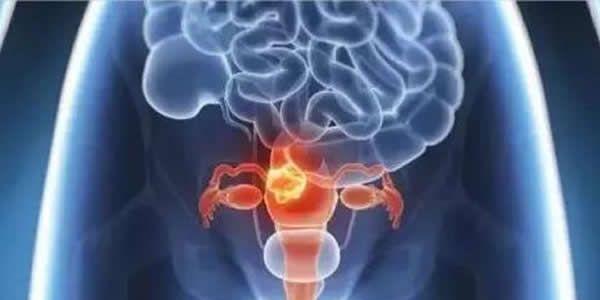 没有卵巢可以做试管婴儿吗 女性没有卵巢还能生孩子吗